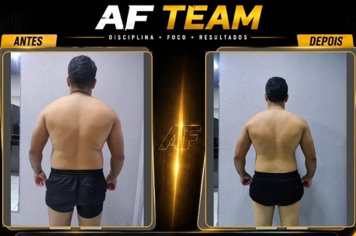 Comparativo antes e depois de costas de aluno da AF TEAM após acompanhamento